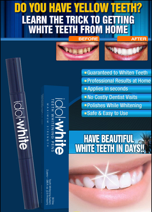 Idol White Teeth Whitening